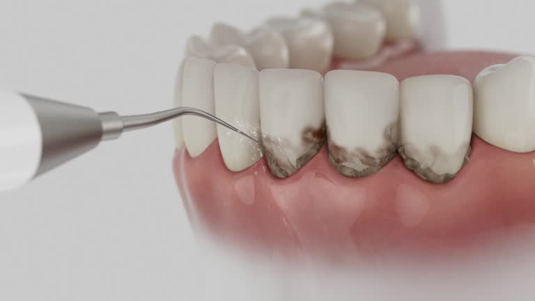 Trusted Teeth Whitening service in La Follette, TN - Dentist Open Now